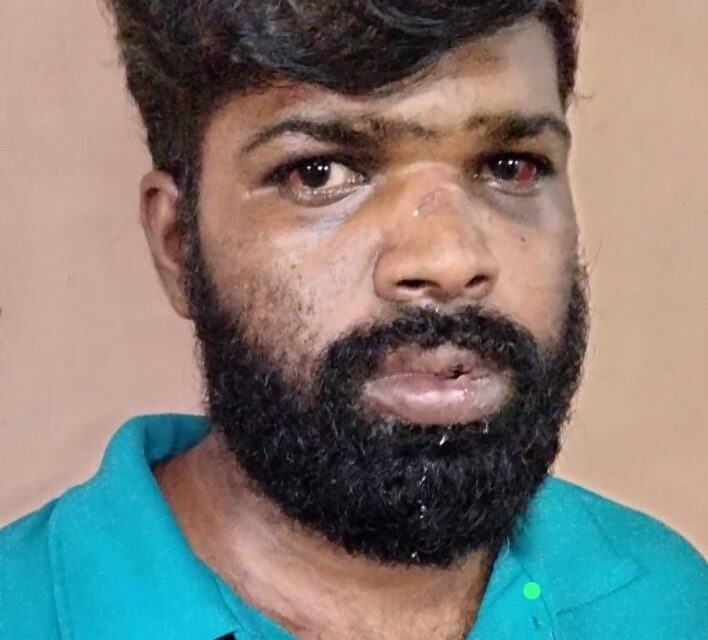 വീട്ടില്‍ അതിക്രമിച്ചു കയറി  ആഭരണങ്ങള്‍  കവര്‍ന്ന  തമിഴ്‌നാട് സ്വദേശി പിടിയില്‍