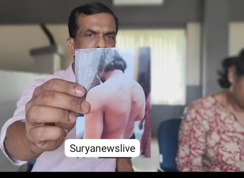 വിഷാദരോഗി കൂടിയായ മകനെ നടുറോഡില്‍ തല്ലിച്ചതച്ച എസ്ച്ച്ഒയ്‌ക്കെതിരെ നിയമനടപടിക്ക് മാതാപിതാക്കള്‍, കുരുക്ക് മുറുക്കി പോലീസ്‌