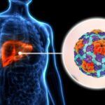 കോട്ടയത്ത്ഹെപ്പറ്റൈറ്റിസ് എ രോഗബാധ: ജാഗ്രത വേണമെന്ന് അധികൃതർ