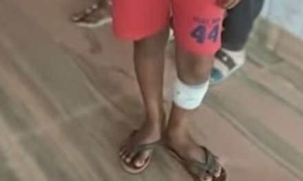 ക്രൂരത ; മൂന്നാം ക്ലാസുകാരനെ ഇസ്തിരിപ്പെട്ടി ചൂടാക്കി പൊളിച്ചു : ചാർജറിന്റെ വയർ കൊണ്ട് അടിച്ചു; ദേഷ്യത്തിൽ ചെയ്തതെന്ന് പിതാവ്