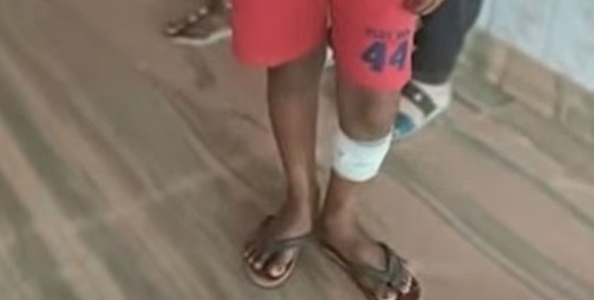 ക്രൂരത ; മൂന്നാം ക്ലാസുകാരനെ ഇസ്തിരിപ്പെട്ടി ചൂടാക്കി പൊളിച്ചു : ചാർജറിന്റെ വയർ കൊണ്ട് അടിച്ചു; ദേഷ്യത്തിൽ ചെയ്തതെന്ന് പിതാവ്