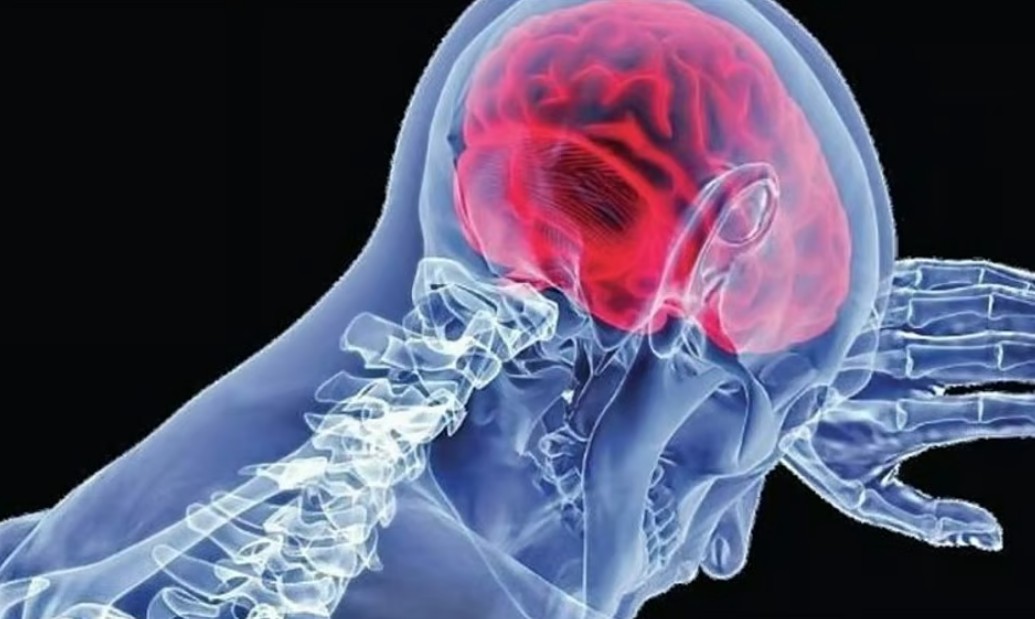 കോഴിക്കോട് ഒരാള്‍ക്ക് കൂടി അമീബിക് മസ്തിഷ്‌കജ്വരം; 43 കാരി മെഡിക്കല്‍ കോളജില്‍ ചികിത്സയില്‍