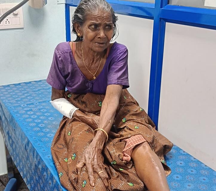 തലയോലപറമ്പില്‍ സ്വകാരൃബസ് കാല്പാദത്തിലൂടെ  കയറി ഇറങ്ങി വയോധികക്ക് ഗുരുതര പരിക്ക്