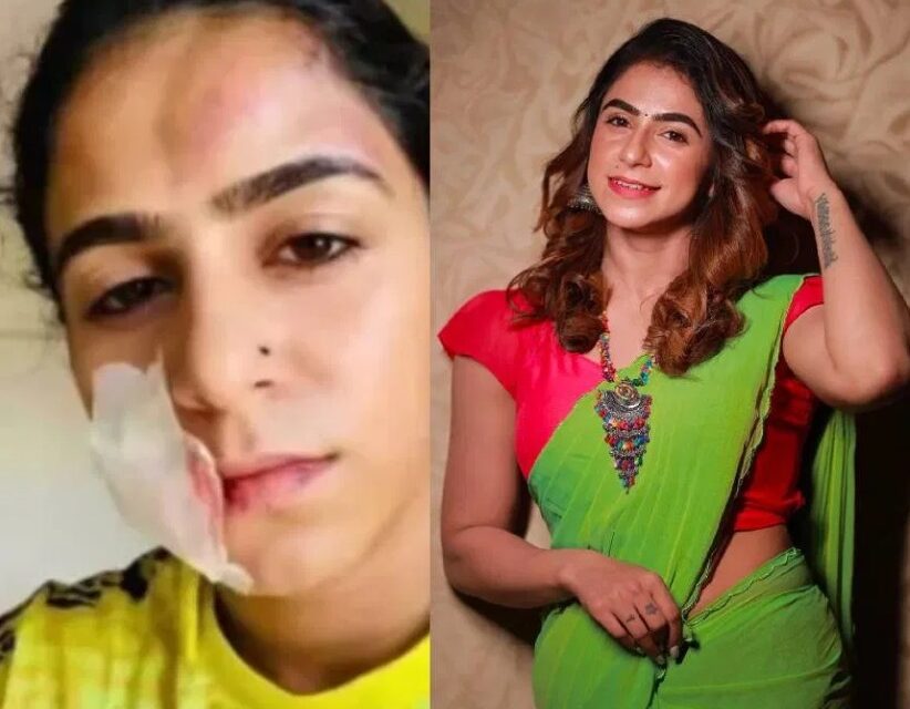 ‘അയാൾ എൻ്റെ വയറ്റിൽ ചവിട്ടി, മുഖത്ത് വള ചേർത്ത് ഇടിച്ചു’;  കാമുകനിൽ നിന്നും അനുഭവിച്ച ശാരീരിക-മാനസീക ക്രൂര പീഡനങ്ങൾ വെളിപ്പെടുത്തി ജസീല