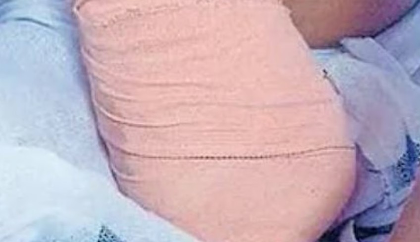 ‘അമ്മേ എന്റെ കൈ കാണാനില്ലമ്മേ… മുറിച്ചു കളഞ്ഞോ…’;നാലാം ക്ലാസുകാരിയുടെ പ്ലാസ്റ്ററിട്ട കൈ മുറിച്ചു മാറ്റി, ചികിത്സപ്പിഴവ്