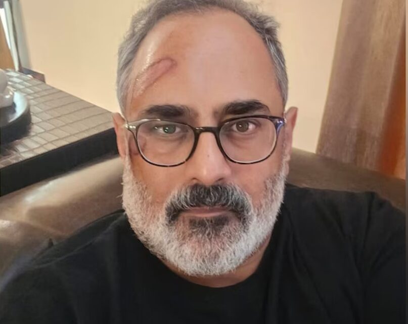 വേദനയോടെയാണെങ്കിലും വിലപ്പെട്ട ഒരു പാഠം പഠിക്കാന്‍ കഴിഞ്ഞു’;രാജീവ് ചന്ദ്രശേഖറിന് വീണ് പരിക്കേറ്റു