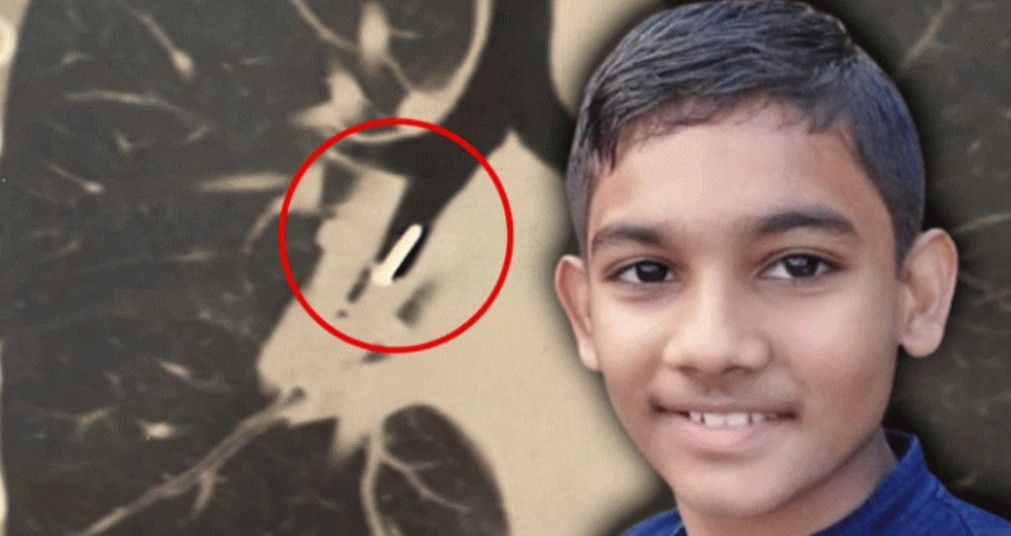 സ്‌കൂൾ നോട്ടീസ് ബോർഡിലെ പിൻ അബദ്ധത്തിൽ വിഴുങ്ങി; ഏഴാം ക്ലാസുകാരൻ മരിച്ചു