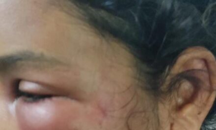 കോട്ടയത്ത് ഭാര്യയെ ഭർത്താവ് ക്രൂരമായി മർദ്ദിച്ചതായി പരാതി, മുഖത്ത് പരുക്ക്; മക്കളെയും ഉപദ്രവിക്കാറുണ്ടെന്ന് മൊഴി