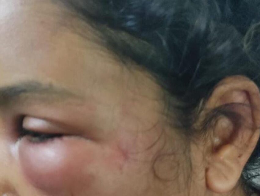 കോട്ടയത്ത് ഭാര്യയെ ഭർത്താവ് ക്രൂരമായി മർദ്ദിച്ചതായി പരാതി, മുഖത്ത് പരുക്ക്; മക്കളെയും ഉപദ്രവിക്കാറുണ്ടെന്ന് മൊഴി