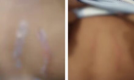 മറ്റൊരു മുറിയില്‍ പോയി കിടക്ക് : കാമുകിയോടൊപ്പം കിടക്കാൻ കുട്ടി സമ്മതിക്കുന്നില്ല ,കലികയറിയ കാമുകൻ 12 വയസുകാരനെ ക്രൂരമായി മർദിച്ചു : തല ഭിത്തിയിലിടിപ്പിച്ചു, നെഞ്ചിൽ മാന്തി: അമ്മയും ആൺസുഹൃത്തും പിടിയിൽ