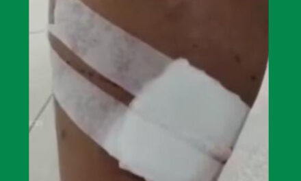 ഭവനസന്ദര്‍ശനം നടത്തുന്ന സ്ഥാനാര്‍ത്ഥികളേ, നായ ഇല്ലായെന്ന് കൂടി ഉറപ്പുവരുത്തിക്കോ, ബൈസണ്‍വാലിയില്‍ സ്ഥാനാര്‍ത്ഥിയെ നായ കടിച്ചു