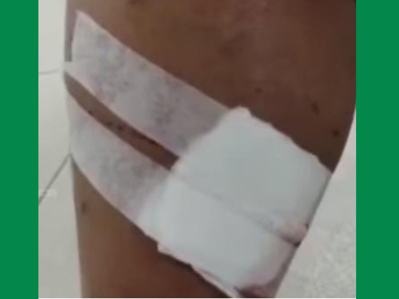 ഭവനസന്ദര്‍ശനം നടത്തുന്ന സ്ഥാനാര്‍ത്ഥികളേ, നായ ഇല്ലായെന്ന് കൂടി ഉറപ്പുവരുത്തിക്കോ, ബൈസണ്‍വാലിയില്‍ സ്ഥാനാര്‍ത്ഥിയെ നായ കടിച്ചു