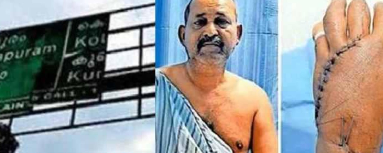 സൈന്‍ ബോർഡില്‍ നിന്നും ലോഹപാളി അടർന്ന് വീണു; സ്കൂട്ടർ യാത്രികൻ്റെ കൈ അറ്റുതൂങ്ങി : സംഭവം കൊല്ലത്ത്
