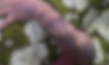 എട്ട് മാസം ഗർഭിണിയായ യുവതിയെ ഇസ്തിരിപ്പെട്ടി കൊണ്ട് പൊളിച്ചു ; പങ്കാളി അറസ്റ്റിൽ