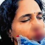 ക്ലാസിൽ ഗെയിം കളിക്കരുതെന്ന് താക്കീത് ചെയ്തു ; മാലദ്വീപിൽ വിദ്യാർത്ഥിയുടെ ആക്രമണത്തിൽ മലയാളി അധ്യാപികയ്ക്ക് ഗുരുതര പരിക്ക്; മൂക്ക് ഇടിച്ചു തകർത്ത്, അടിയന്തര ശസ്ത്രക്രിയ വേണം