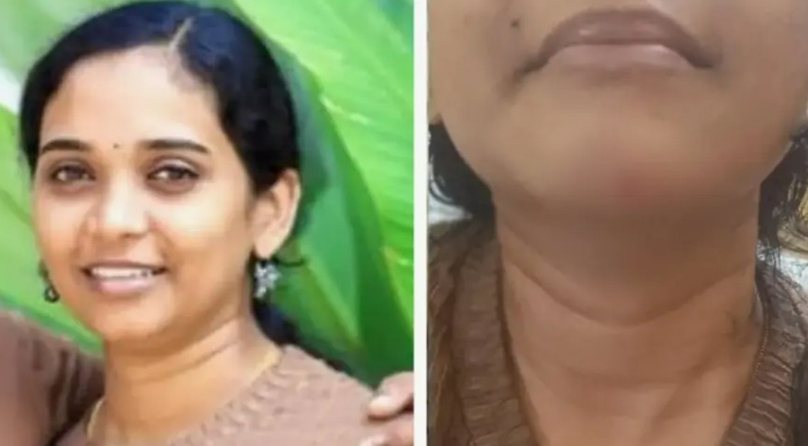 ആറ്റുകാലില്‍ വാടക വീട്ടില്‍ യുവതി മരിച്ച നിലയില്‍; ഭര്‍തൃപീഡനമെന്ന ആരോപണവുമായി കുടുംബം, ശാരീരിക പീഡനത്തിന്റെ ചിത്രങ്ങൾ അമ്മയ്ക്ക് അയച്ചു നൽകി