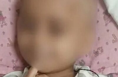 മരുന്ന് മാറി കുത്തിവച്ചു മൂന്നുവയസുകാരൻ മരിച്ച സംഭവം നേഴ്സുമാർക്കെതിരെ കേസ് :സംഭവം AIMS ആശുപത്രിയിൽ