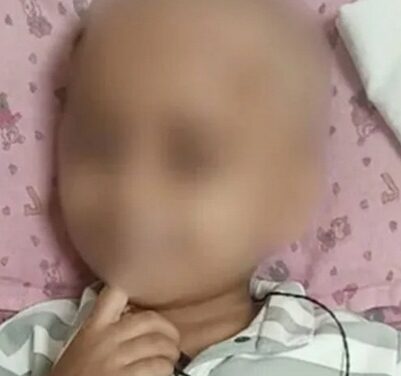 മരുന്ന് മാറി കുത്തിവച്ചു മൂന്നുവയസുകാരൻ മരിച്ച സംഭവം നേഴ്സുമാർക്കെതിരെ കേസ് :സംഭവം AIMS ആശുപത്രിയിൽ