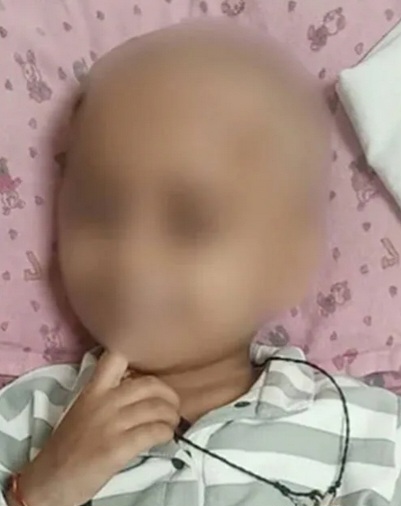 മരുന്ന് മാറി കുത്തിവച്ചു മൂന്നുവയസുകാരൻ മരിച്ച സംഭവം നേഴ്സുമാർക്കെതിരെ കേസ് :സംഭവം AIMS ആശുപത്രിയിൽ