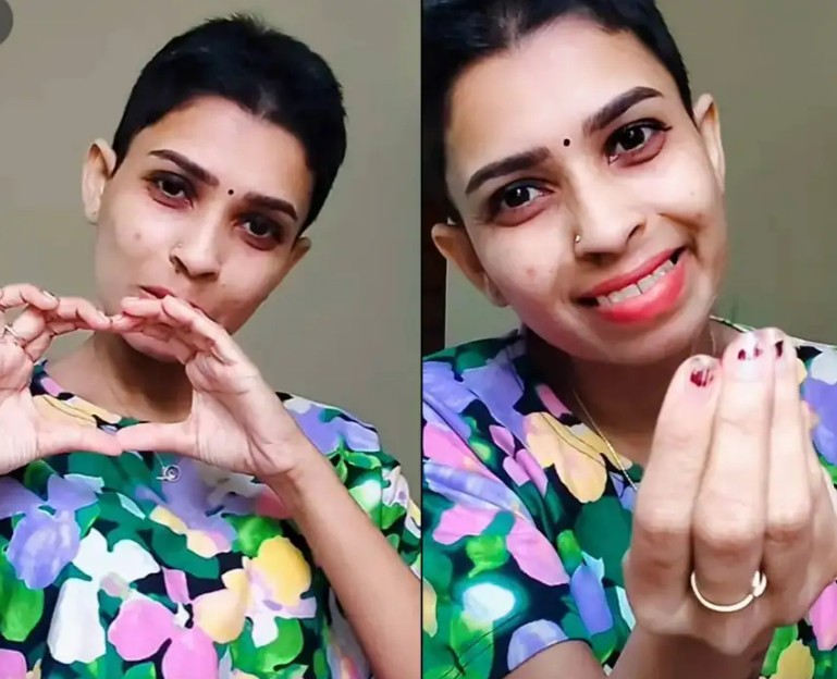 ‘എന്റെ മനസ്സിനല്ല, ശരീരത്തിനാണ് കാൻസർ’, മുടി കൊഴിയുന്നത് ലൈവ് ആയി കാണിച്ച് രേണു സുധി